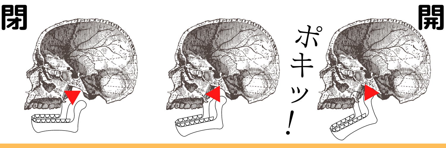 頭蓋骨のイラストで音が鳴る原因を説明